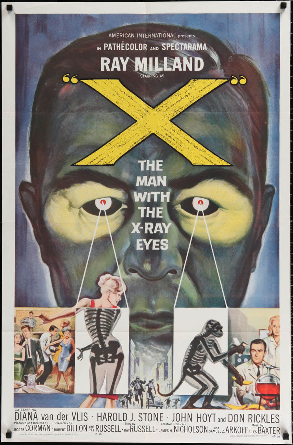 X: The Man With The X-Ray Eyes